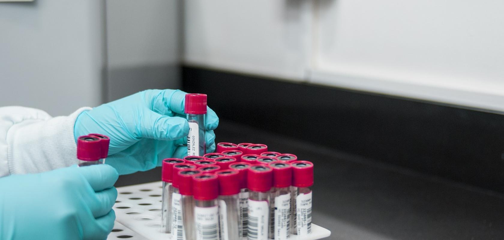 Drug design using AI